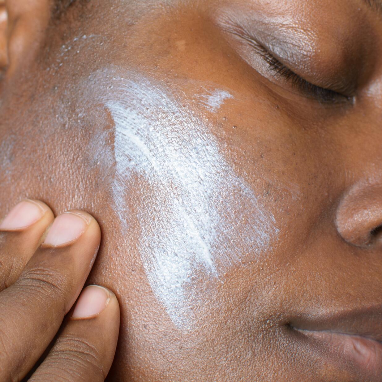 crema facial para cicatrices atróficas para pieles oscuras